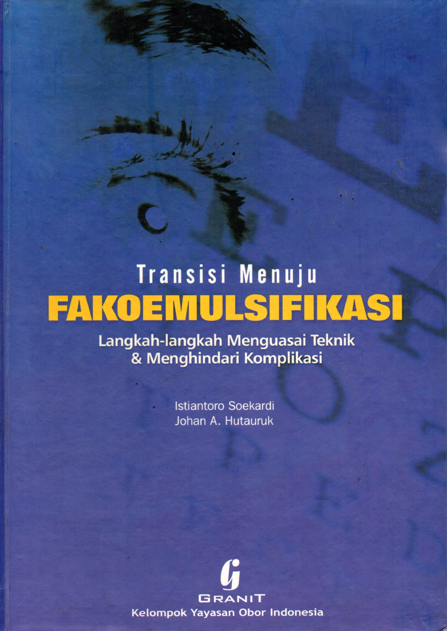 Sampul Transisi Menuju Fakoemulsifikasi :  Langkah-langkah Menguasai Teknik dan Menghindari Komplikasi
