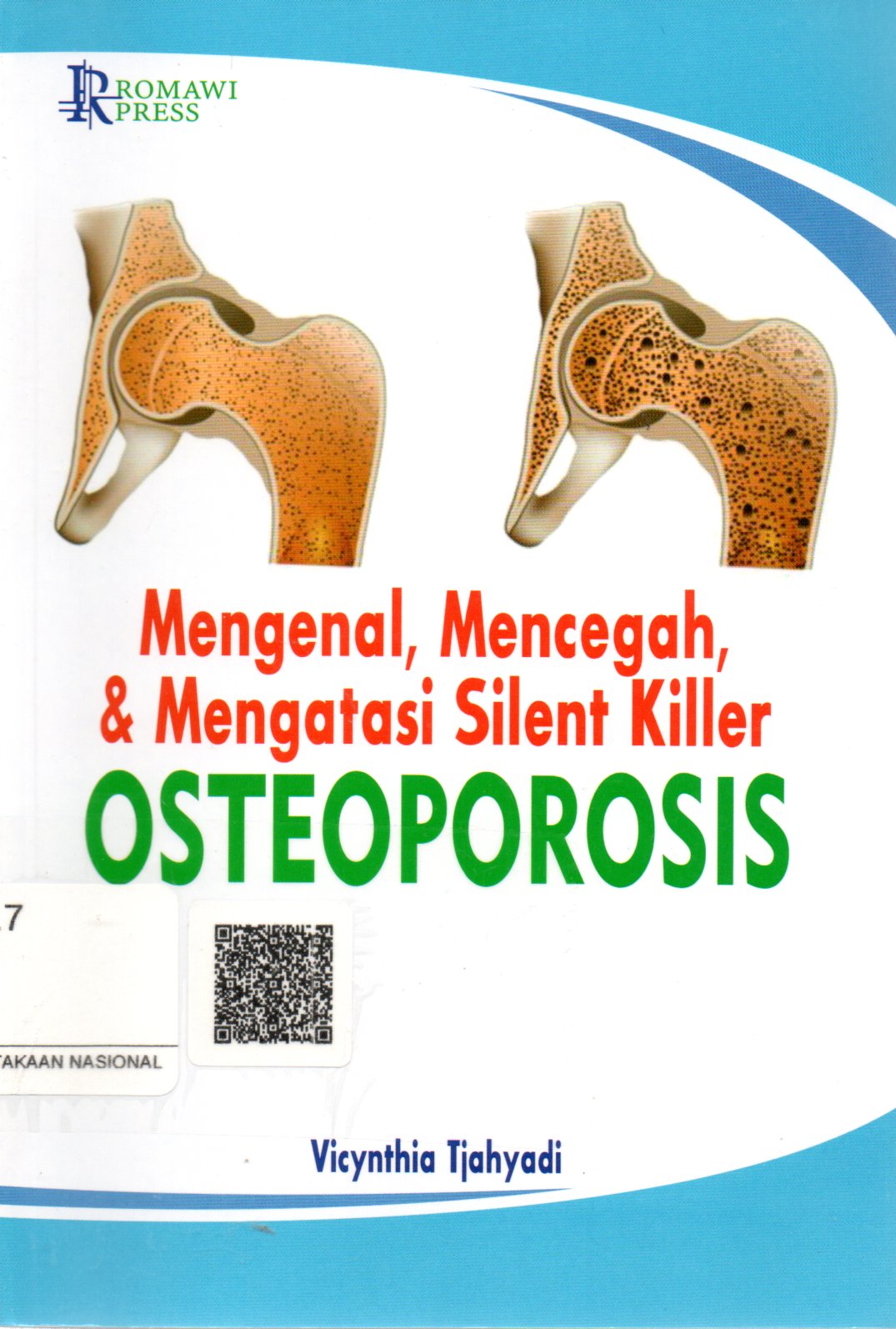 Sampul Mengenal, Mencegah, dan Mengatasi Silent Killer :  Osteoporosis / Editor: Astri Pratiwi