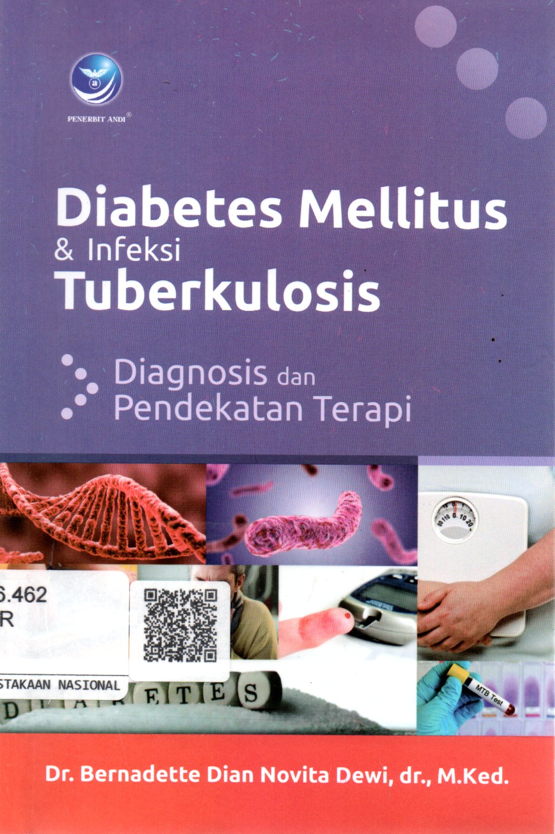 Sampul Diabetes Mellitus dan Infeksi Tuberkulosis :  Diagnosis dan Pendekatan Terapi / Editor: Ratih Indah Utami