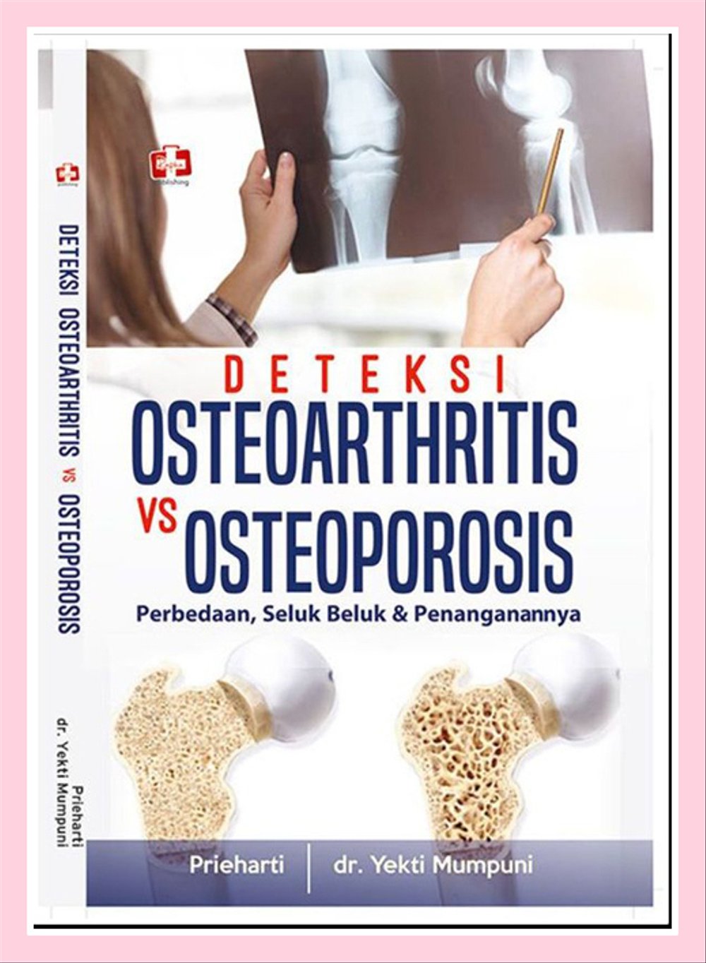 Sampul Deteksi : Osteoarthritis Vs Osteoporosis Perbedaan, Seluk Beluk & Penanganannya