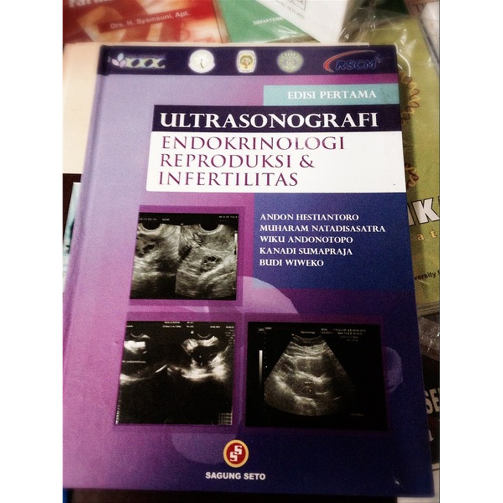 Sampul Ultrasonografi Endokrinologi Reproduksi & Infertilitas / dr. Andon Hestiantoro, Sp.OG (K), Dr. dr. Muharam Natadisastra, Sp.OG (K), dr. Kanadi Sumapraja, Sp. Og (K), dr. Wiku Andonotopo, Sp.OG., Phd