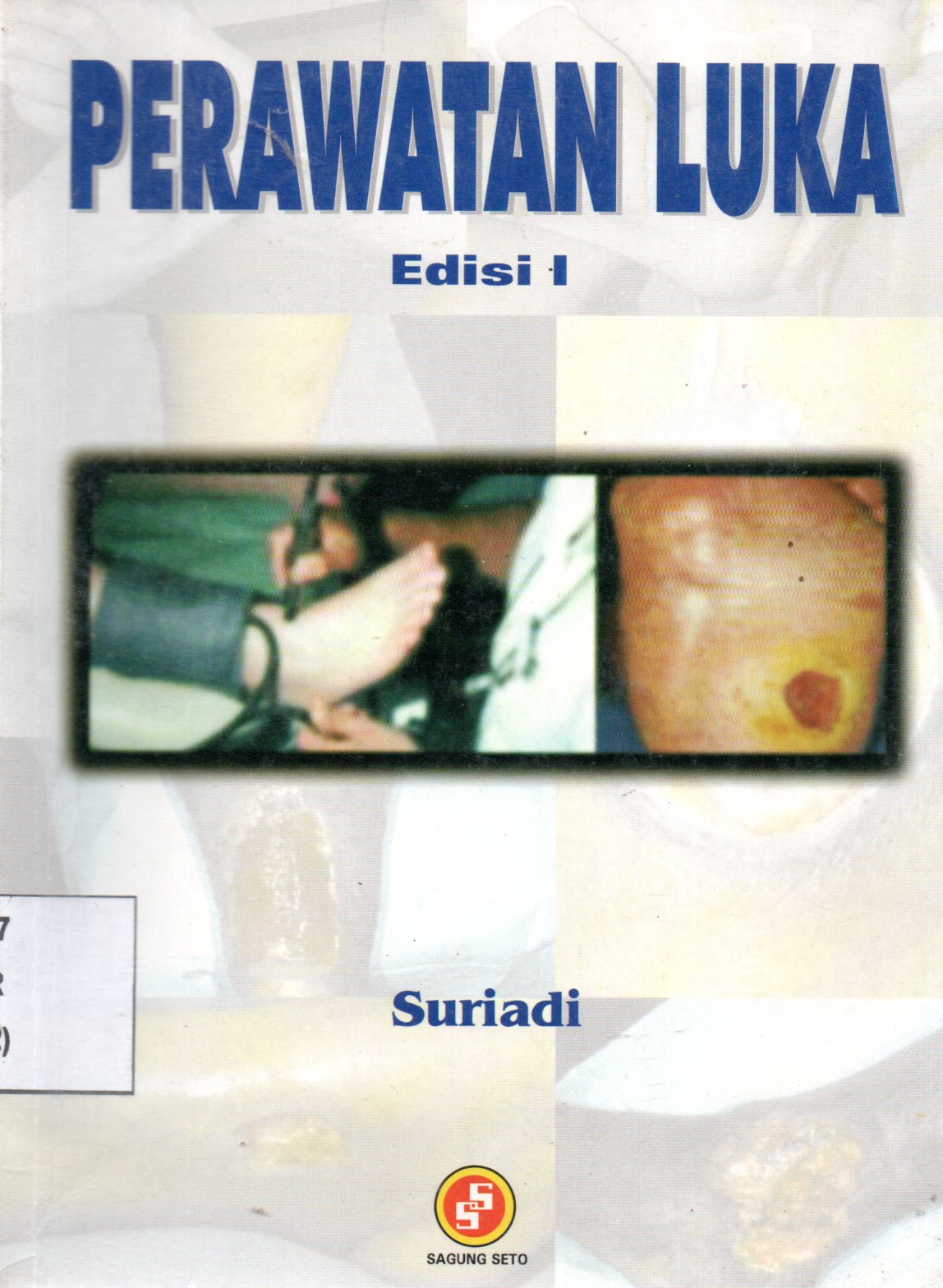Sampul Perawatan Luka