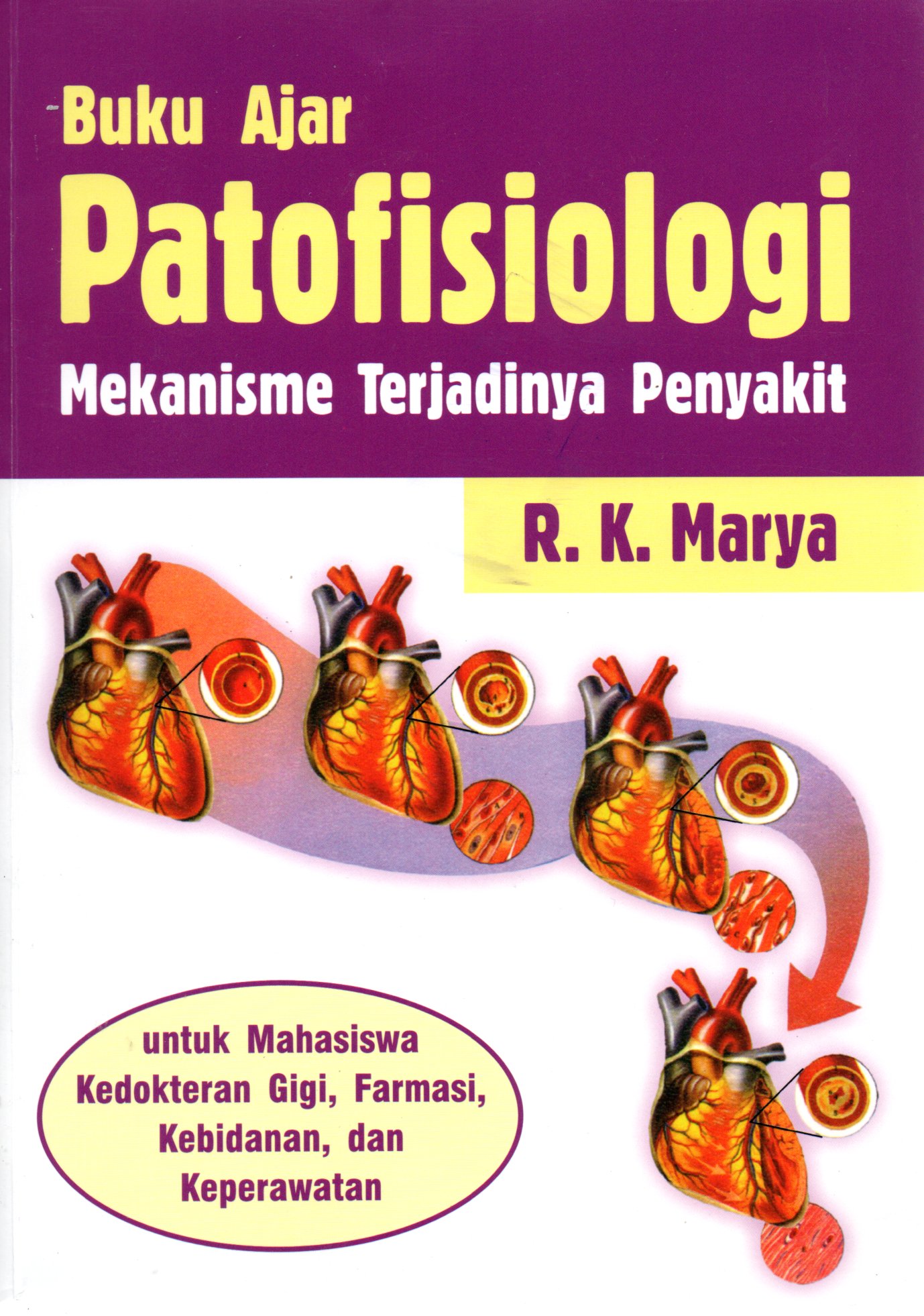 Sampul Buku Ajar Patofisiologi :  Mekanisme Terjadinya Penyakit / Editor: Eka Roina Megawati