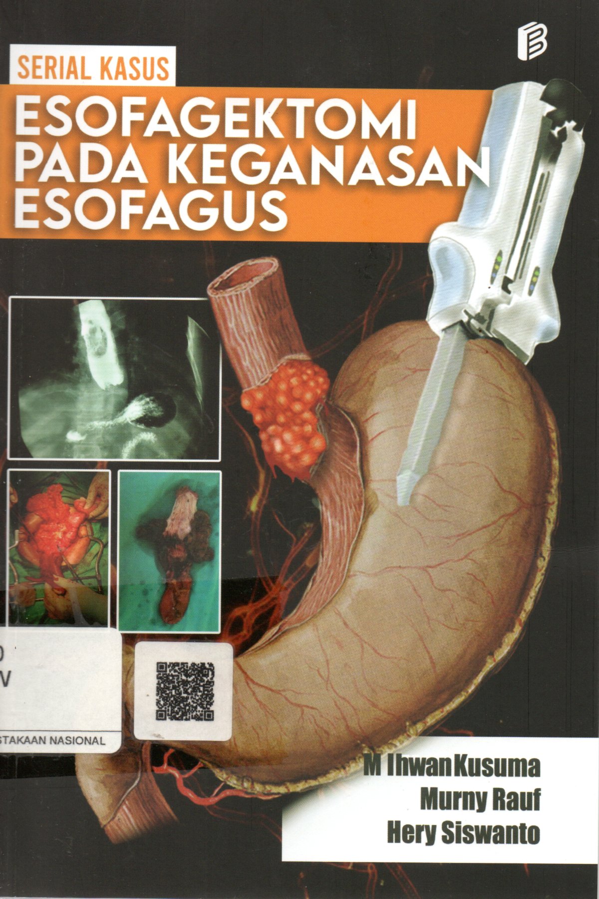 Sampul Serial Kasus Esofagektomi pada Keganasan Esofagus