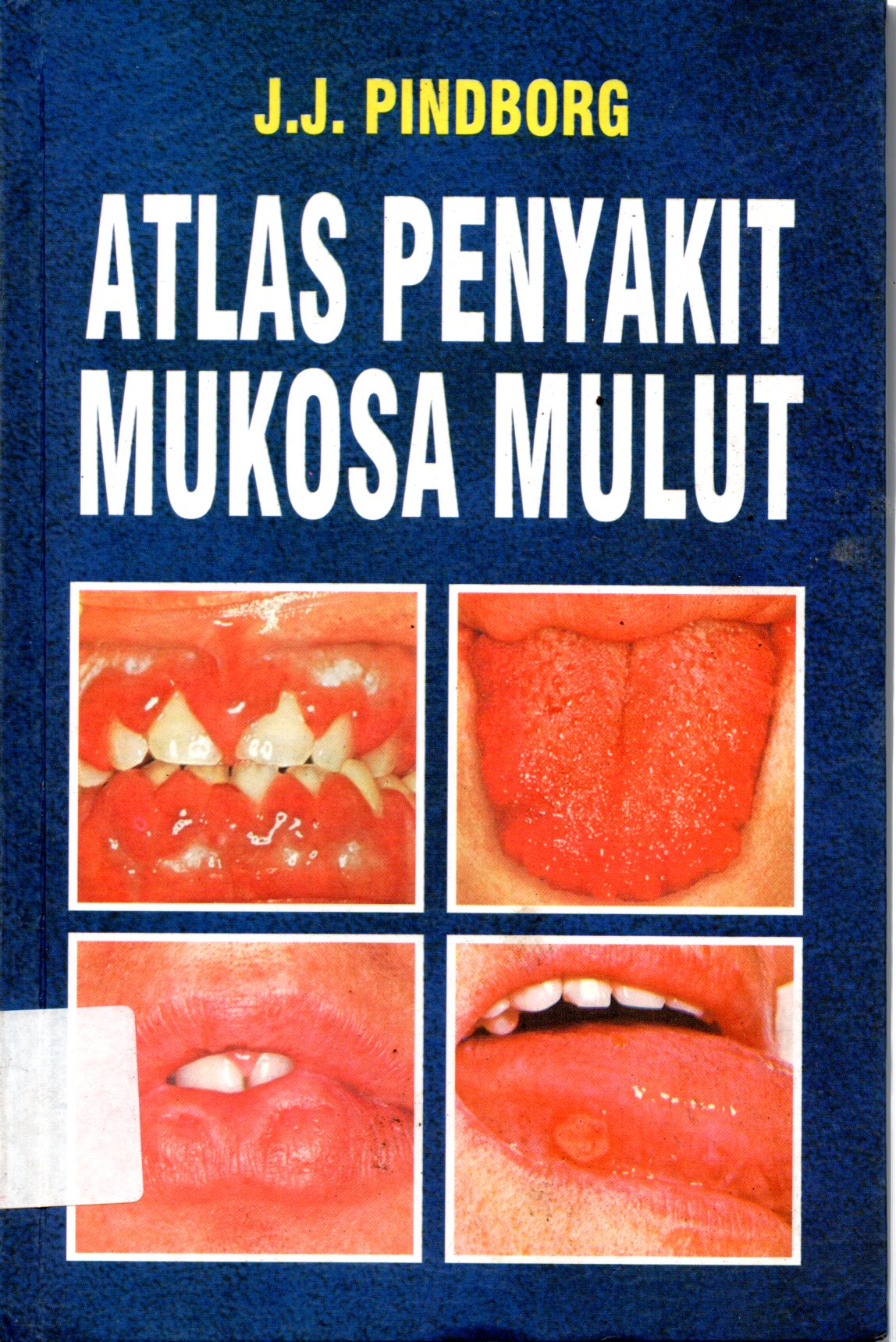 Sampul Atlas Penyakit Mukosa Mulut / Alih Bahasa: Kartika Wangsaraharja